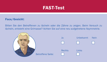Screenshot des Schlaganfall Selbsttests